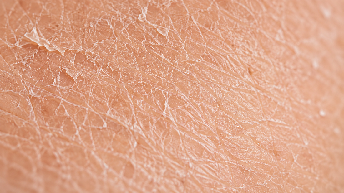 Rutina facial para piel seca: cómo hidratarla de verdad