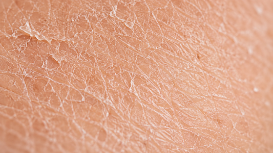Rutina facial para piel seca: cómo hidratarla de verdad